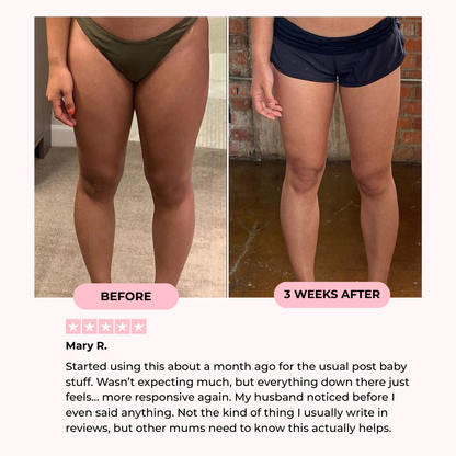 GlowFit V2™ - Thigh and Pelvic Trainer