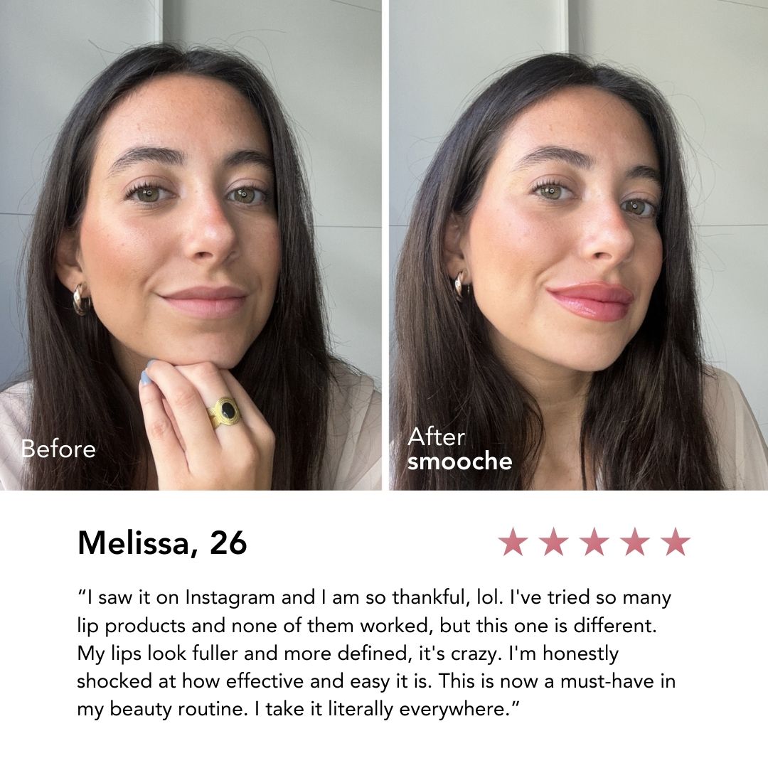 Glowelle® Reedleshot Lip Plumper