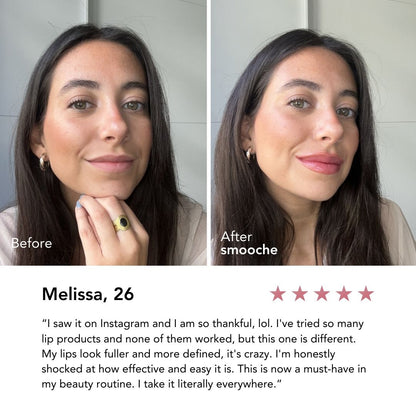 Glowelle® Reedleshot Lip Plumper